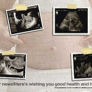 ニューボーンフォト